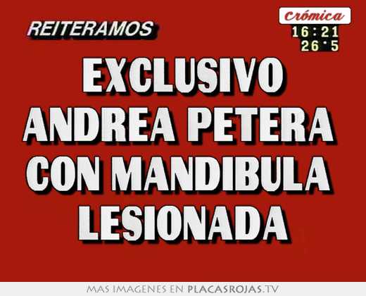 Exclusivo andrea petera  con mandibula  lesionada